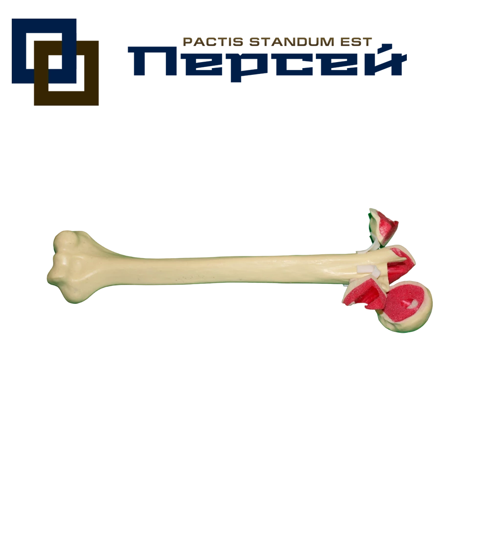 Анатомическая модель "Плечевая кость с четырехфрагментарным переломом в проксимальном отделе"