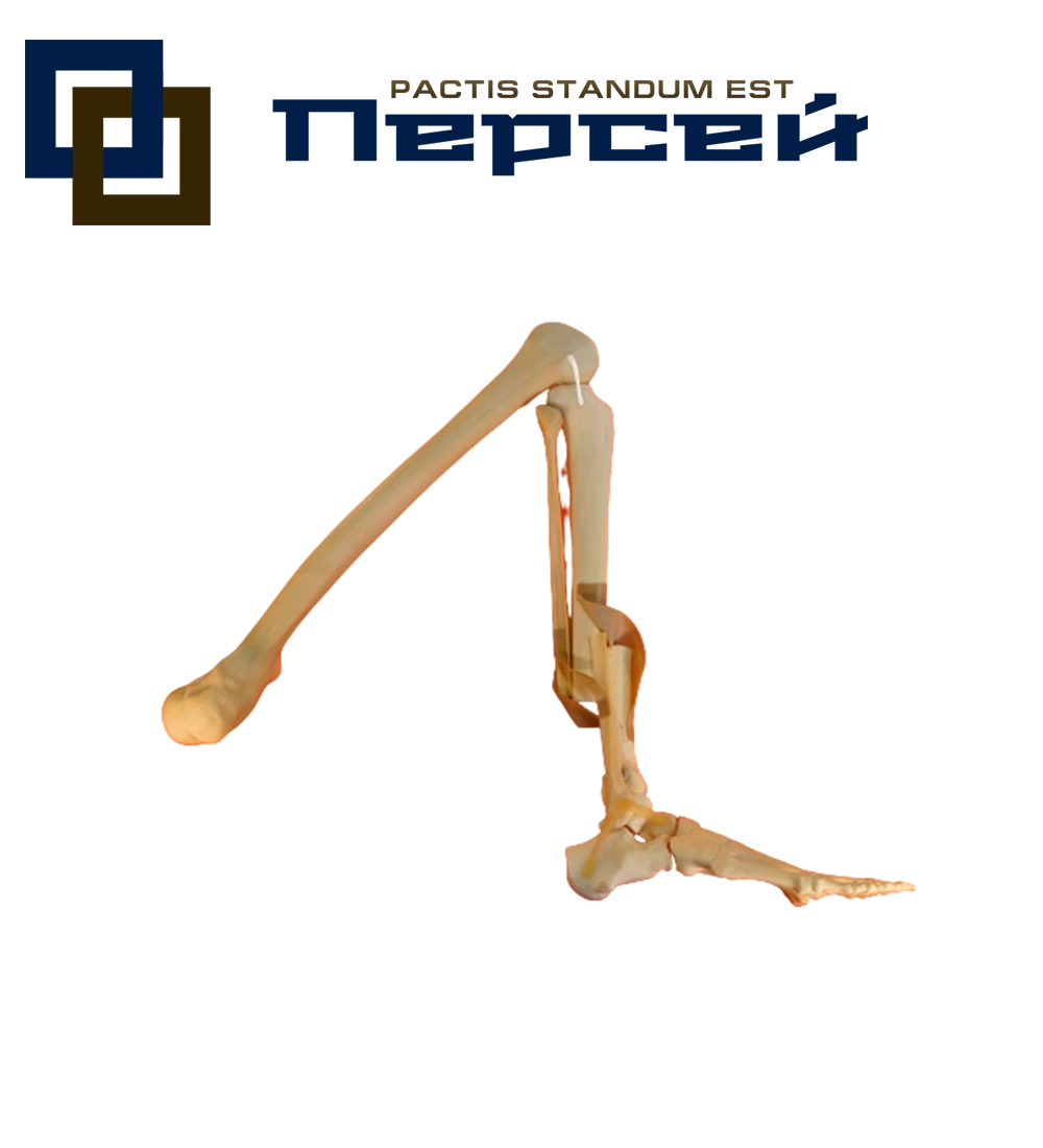 Анатомическая модель "Нижняя конечность со связками и переломом диафиза большеберцовой и малоберцовой костей по типу А3"