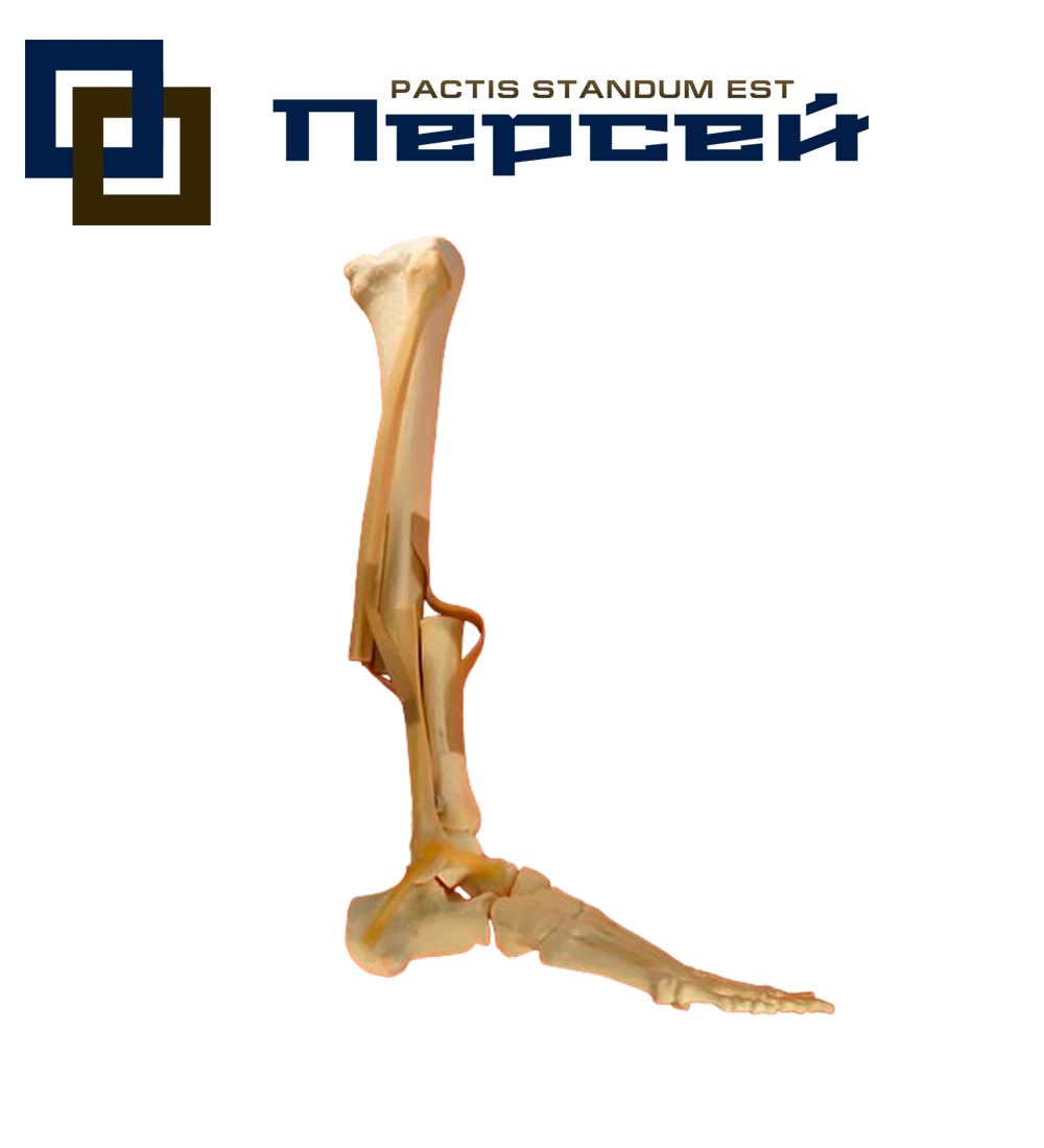 Анатомическая модель "Голеностопный сустав со связками с переломом диафиза большеберцовой и малоберцовой костей по типу А3"