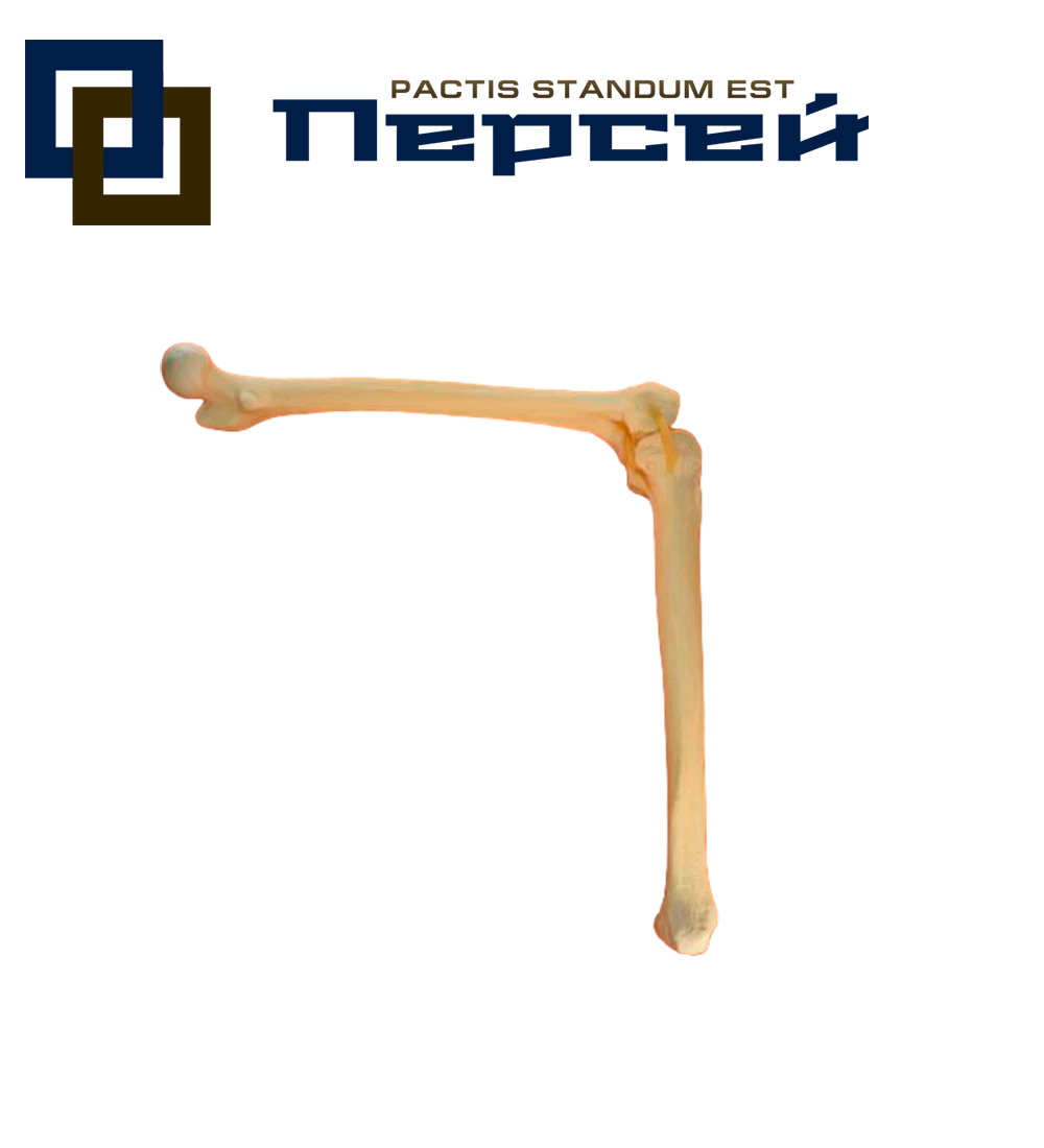 Анатомическая модель "Коленный сустав для протезирования, на резинках"