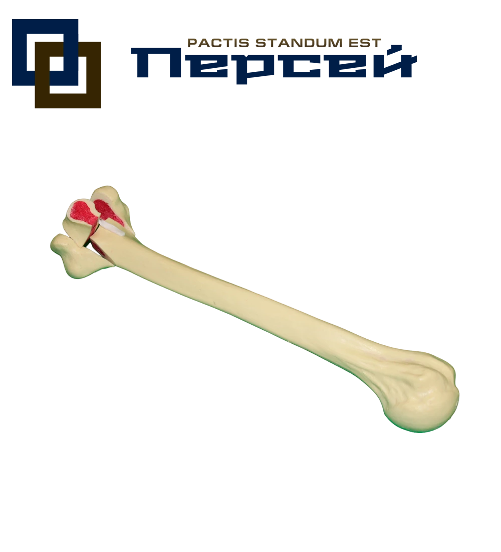 Анатомическая модель "Плечевая кость с внутрисуставным переломом в дистальном отделе"