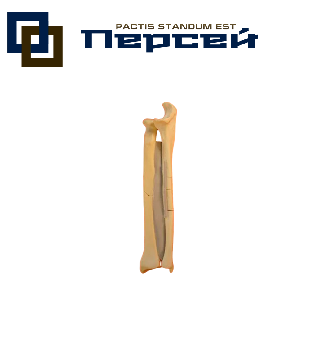Анатомическая модель "Кости предплечья со связками, перелом по типу С2.1"