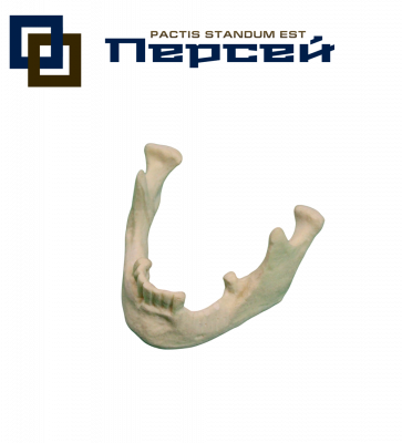 Анатомическая модель "Нижняя челюсть с дефектами зубного ряда"
