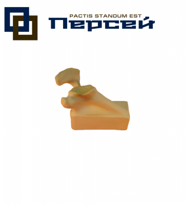 Анатомическая модель "Гленоид лопатки для отработки протезирования"